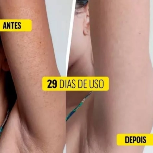 Avon care Derma loção Corporal Uniformizadora de Tom 200ml - Imagem 5
